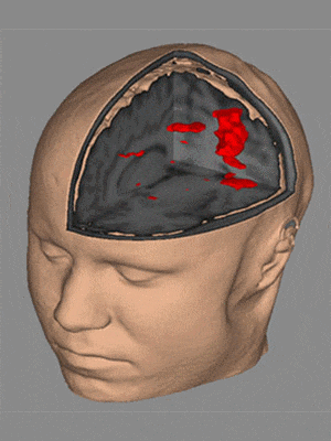 Neurology Seeks MagRez Grad Asst